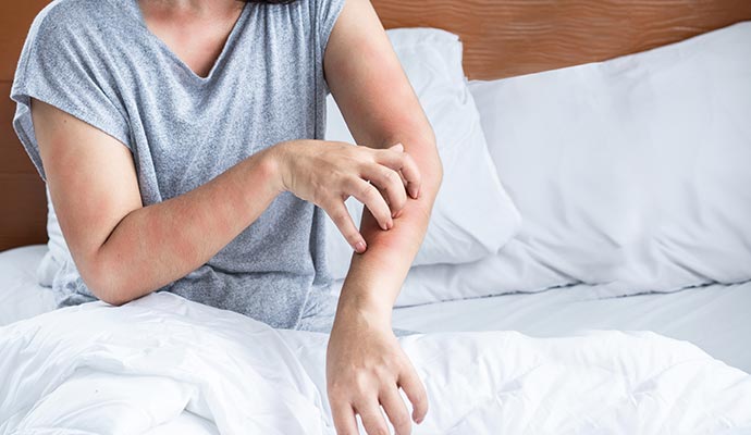 Woman having allergy effects Woman having allergy effects